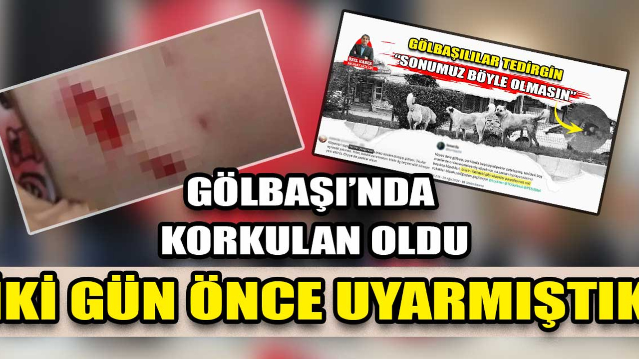 Ankara Gölbaşı'nda sokak köpeği 5 yaşındaki kıza saldırdı!