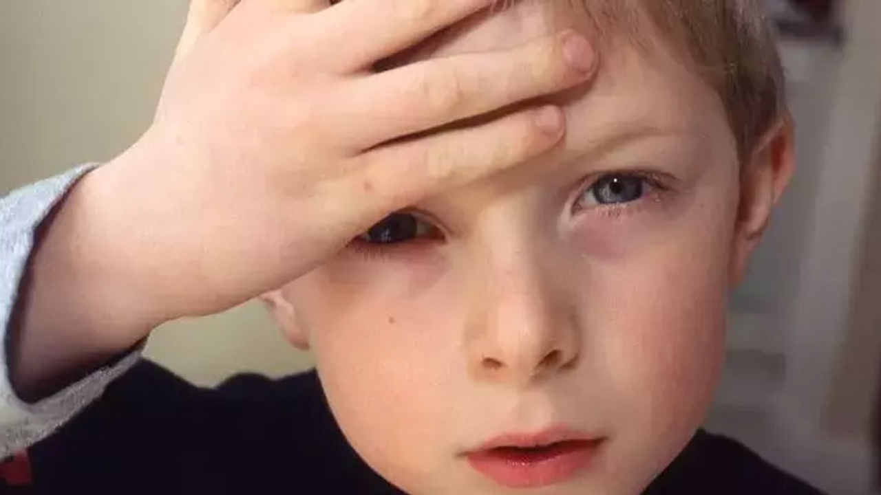 Çocuklarda kafa travmaları: Ebeveynler nelere dikkat etmeli?