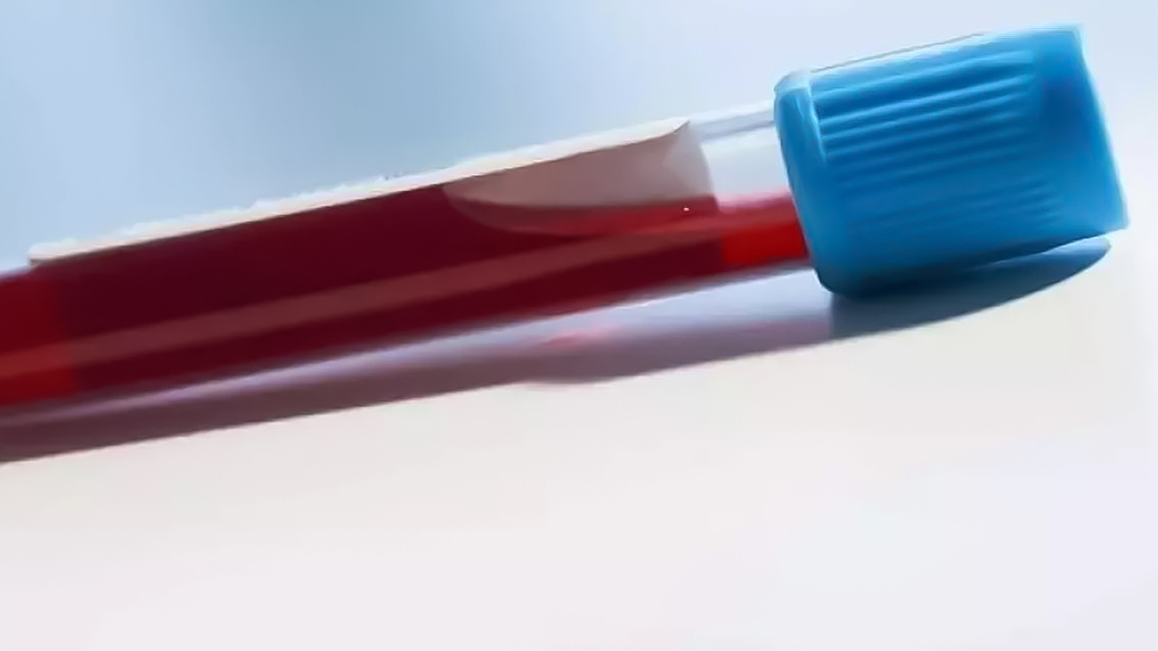 Hayvan kanıyla bakın ne yapacaklar?