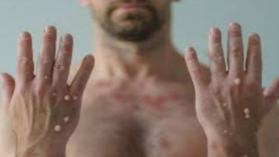 DSÖ uyardı: Bu virüs hala tehdit oluşturuyor