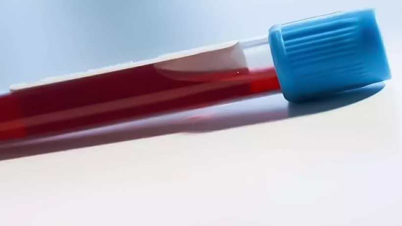 Hayvan kanıyla bakın ne yapacaklar?